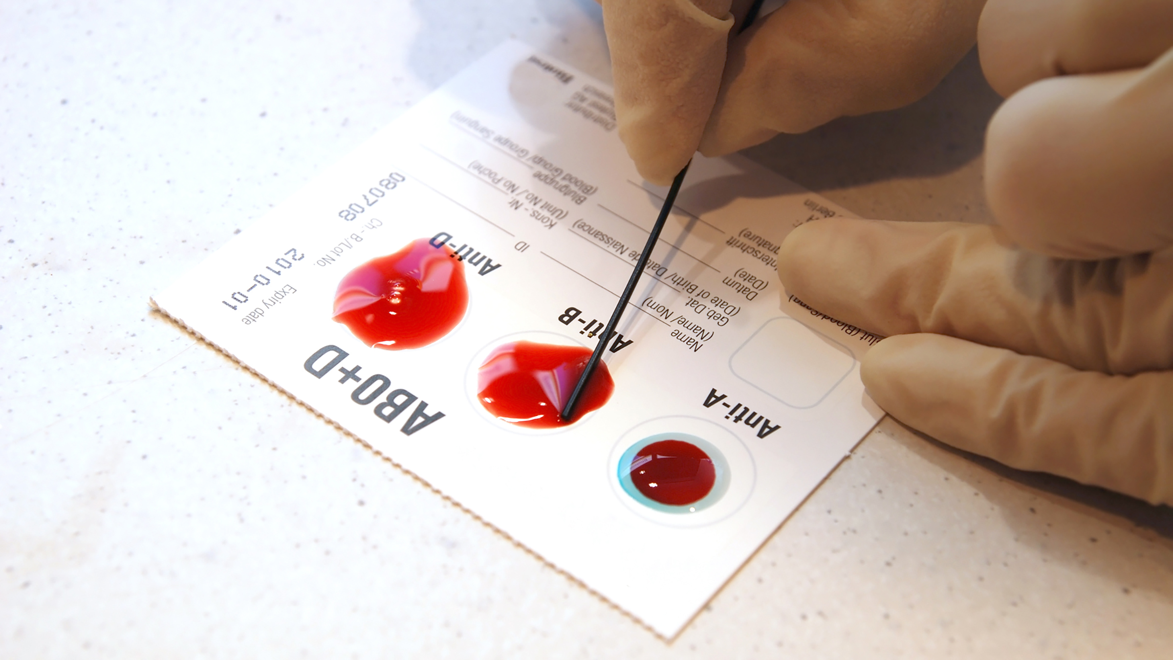 Blood Threads Blood Typing – The Golden Thread